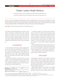 Double-Layered Medial Meniscus
