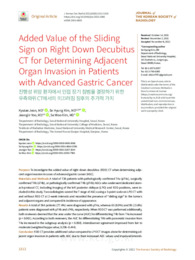 Added Value of the Sliding Sign on Right Down Decubitus CT for Determining Adjacent Organ Invasion in Patients with Advanced Gastric Cancer