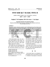 후두에서 발생한 말초 T 세포 림프종, 비특이형 1예