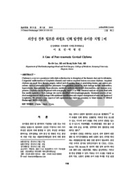 외상성 경부 림프관 파열로 인해 발생한 유미종 치험 1예